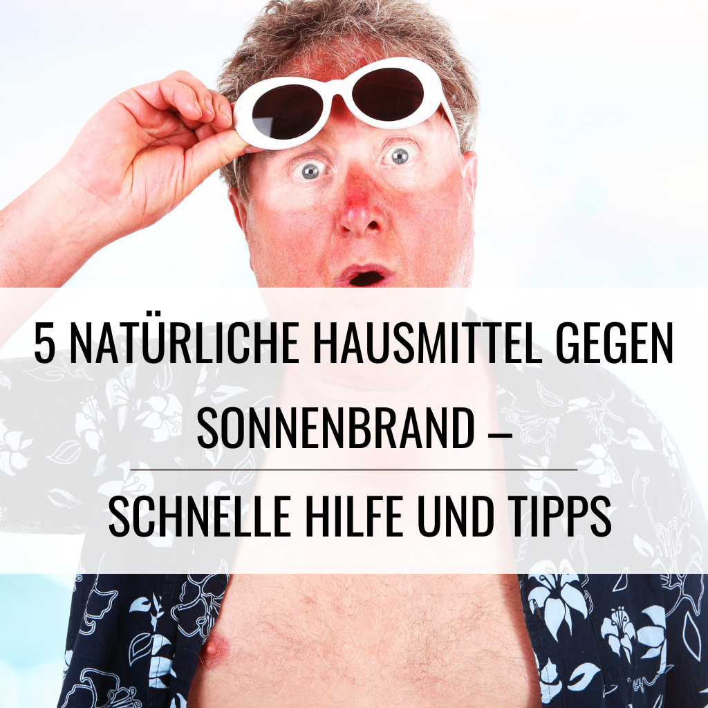 Sonnenbrand, Sommer, Sonne, Urlaub, Hausmittel, natürliche Hausmittel, Sonnenschutz, Kinder, Erwachsene